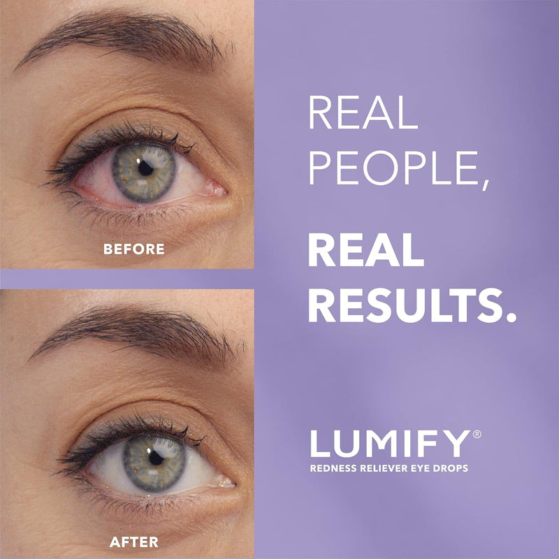 LUMIFY Bausch + Lomb Eye Drops for Red Eyes, Redness Reliever for Brighter Looking Eyes, Works in 1 Minute & Lasts Up to 8 Hours, Eye Drops, 0.08 Fl Oz (2.5 mL)