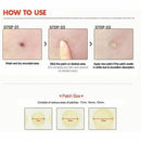 Cosrx Acne Pimple Master Patch 24 Patches Blemish Control Genuine New Sealed